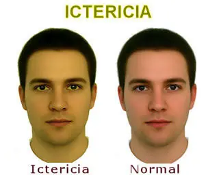 Tenes fatiga y falta de energía ..Seguro puede ser esto
