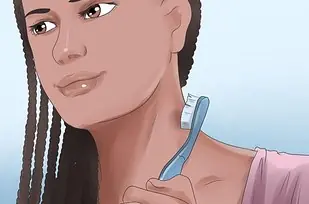 Te dejaron un chupón en el cuello? Pasa lince, y aprende