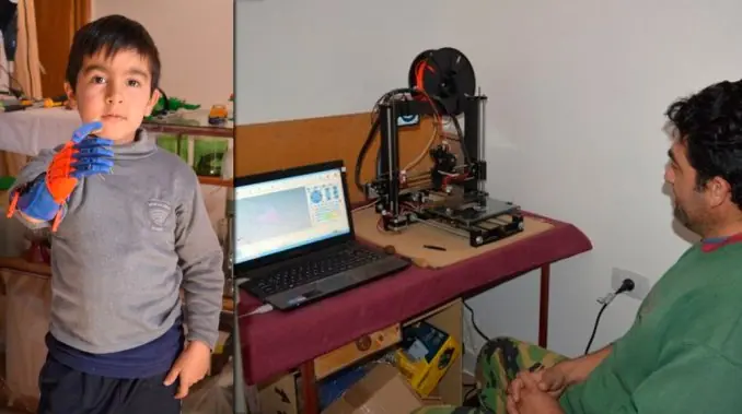 Sin saber de ortopedia, construyó una prótesis para su hijo