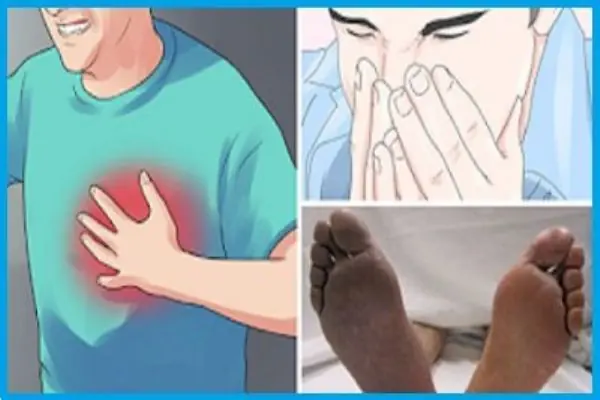Señales que advierten de un posible ataque al corazón