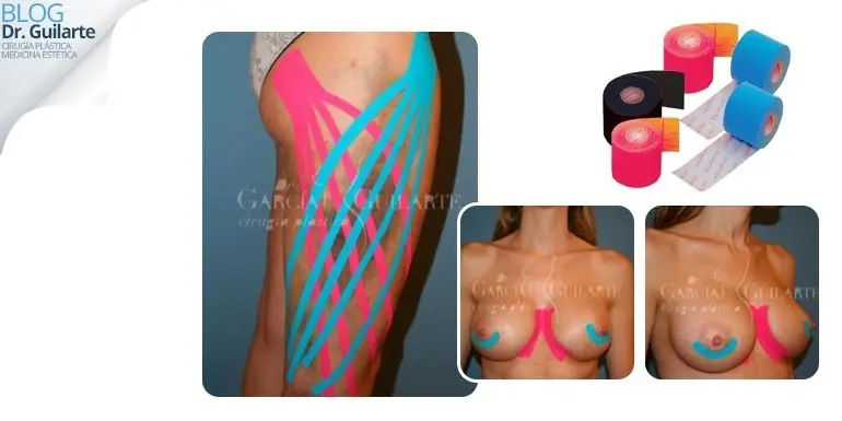 sistema musculoesqueletico