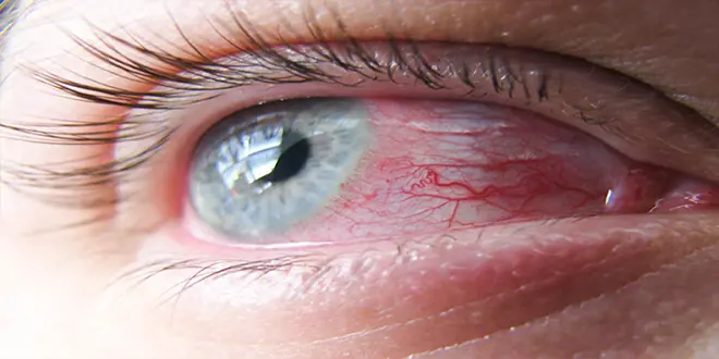 mirando a los ojos
