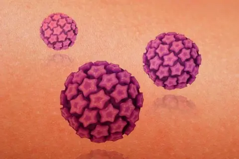 Que es el Virus del Papiloma Humano (VPH o HPV) ?