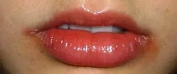 dieta