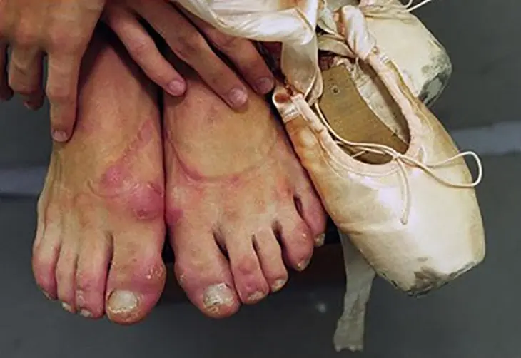 bailarinas