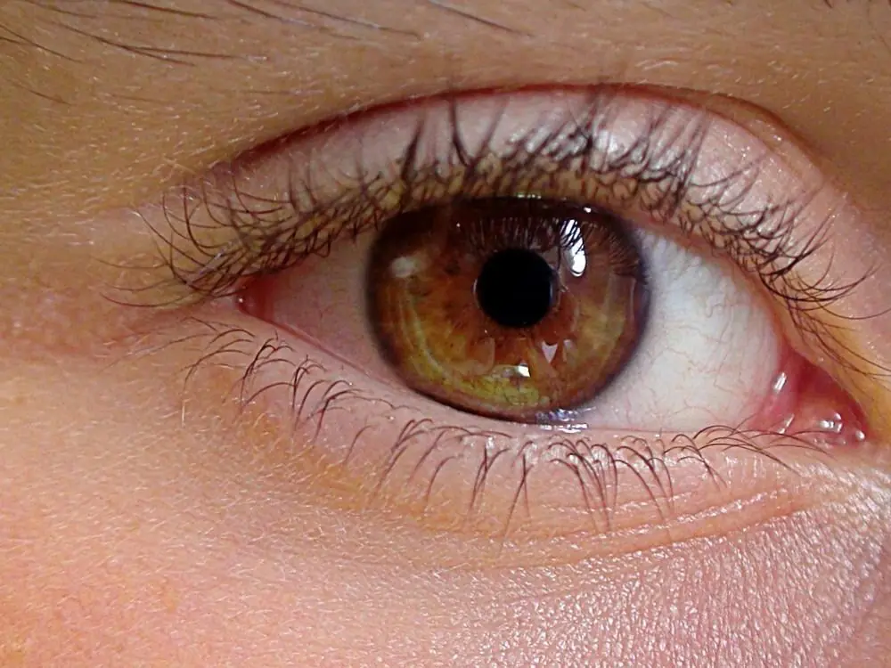 Ojos