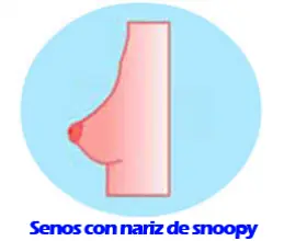 senos