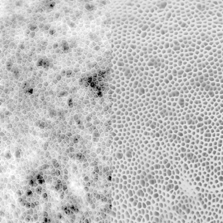 Ciencia te explica el por qué de la tripofobia