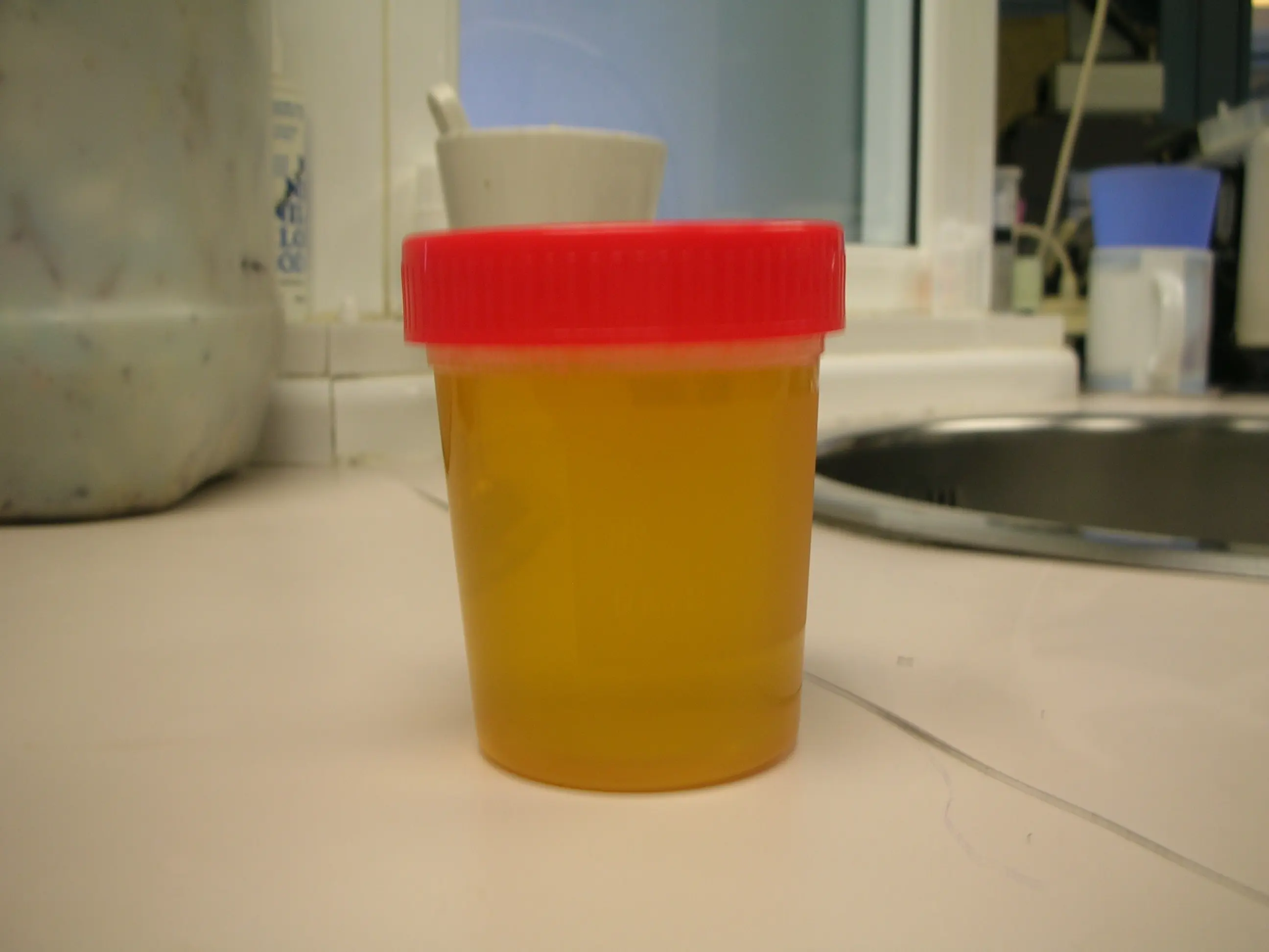 Diagnostico