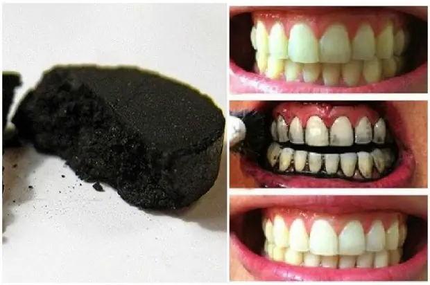 Blanquiar tus dientes sin perder tiempo