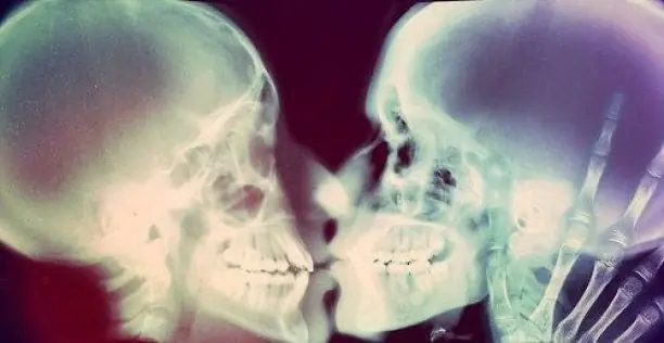 besos