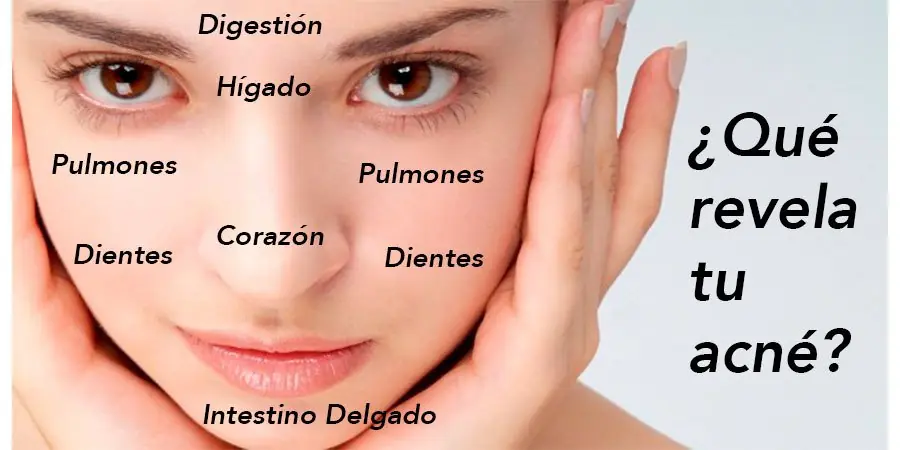 Tenes acne? depende donde salga señala otras afecciones
