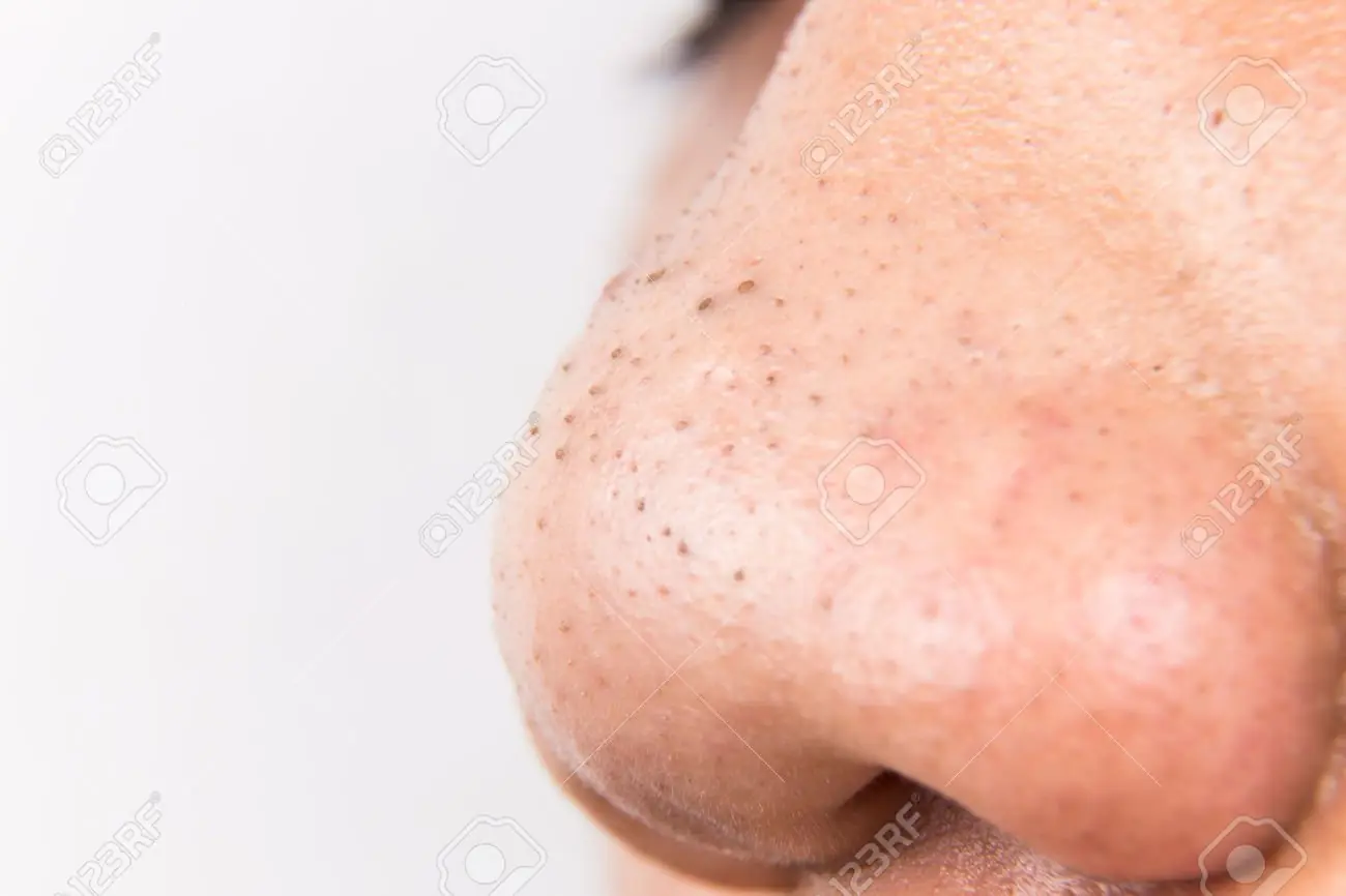 cupero