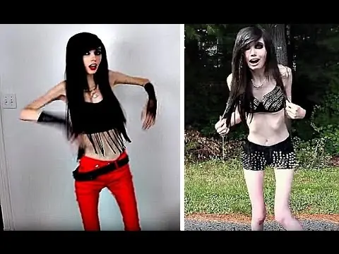 Youtuber anorexica+yapa [apto]PMDM