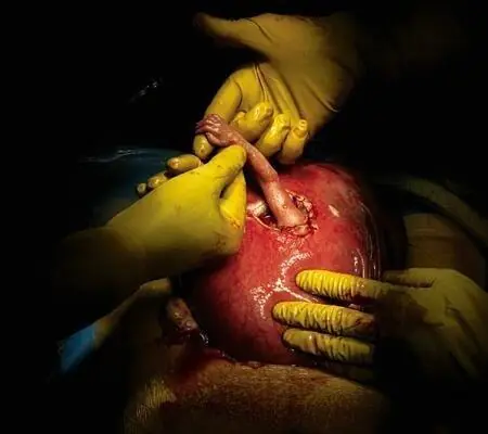imagenes con informacion