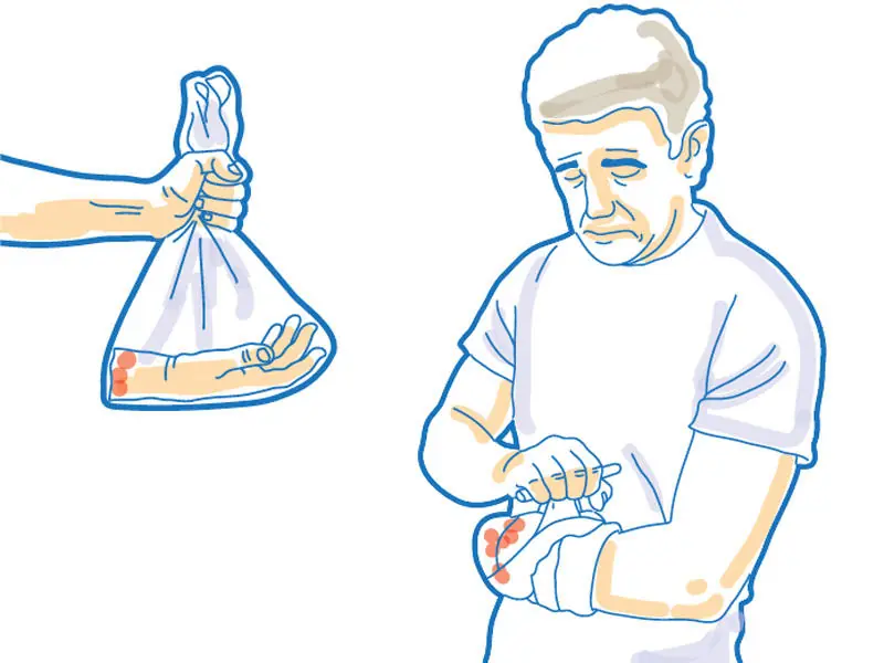 Mejoran sus vidas Protesis en Animales