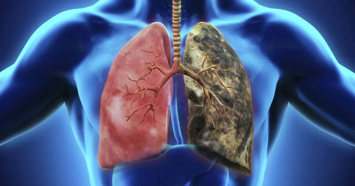 Este carbohidrato mitiga el daño causado por fumar.