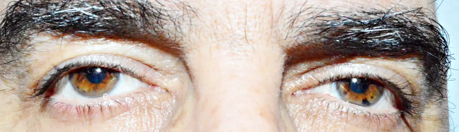 ojo