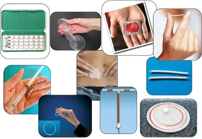 Métodos anticonceptivos que te protegen