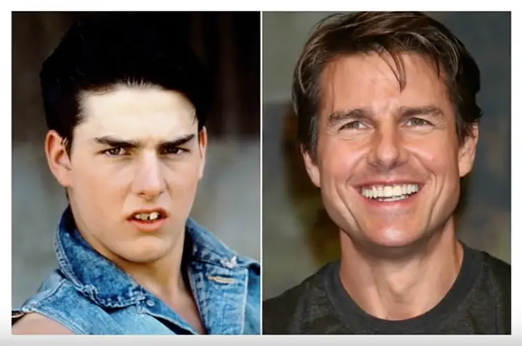 10Famosos