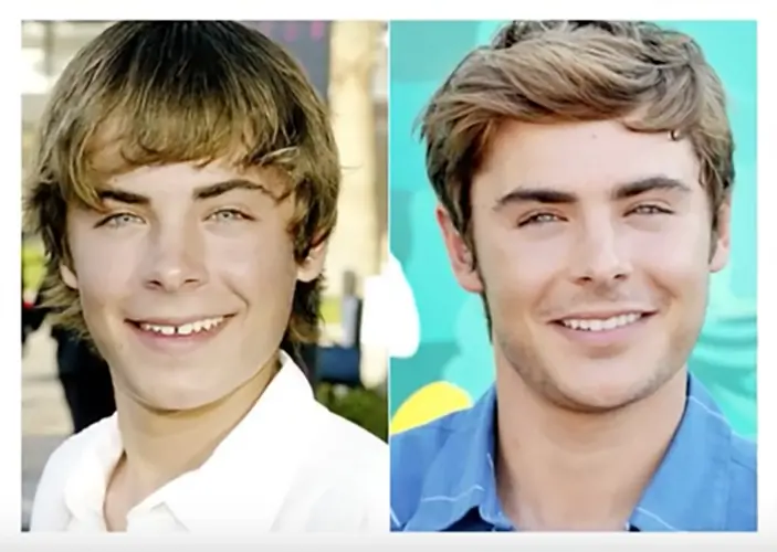 Mira estos 10 famosos transformaron