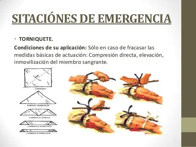 4 lecciones simples de supervivencia...No las conocías! 4 lecciones simples de supervivencia...No las conocías!