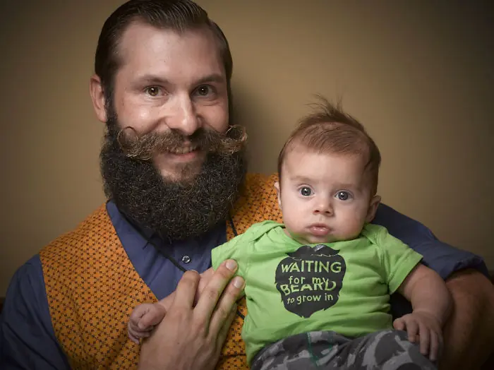barbas