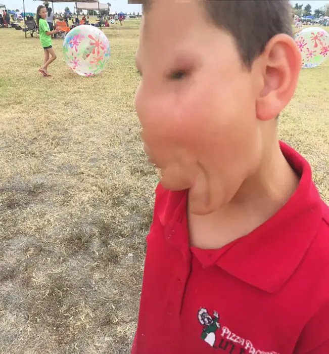 mal