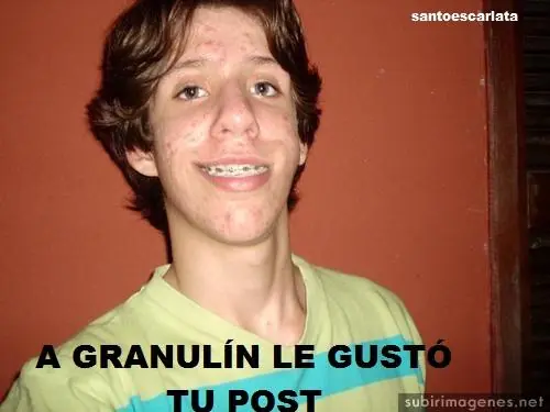 Arruina su cutis tras una limpieza facial