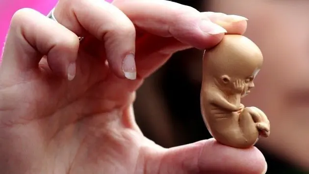 ABORTO
