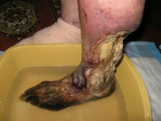 El mal que pudre lo cuerpo del lo ser humano!