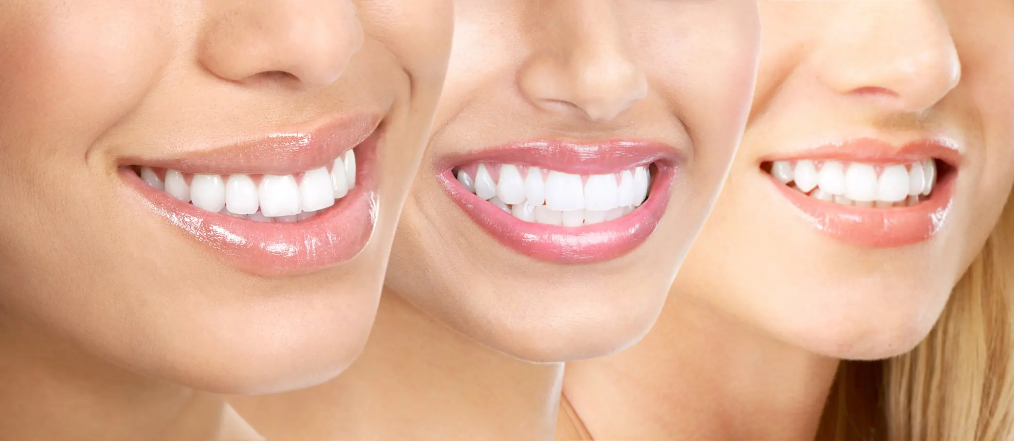 dientes