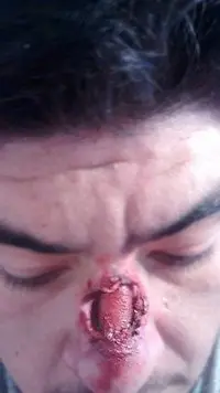 quemado
