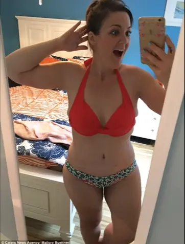 Perdió 100 kilos para cumplir su sueño de posar en bikini