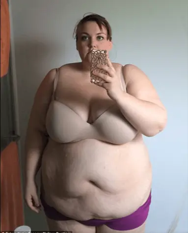 Perdió 100 kilos para cumplir su sueño de posar en bikini