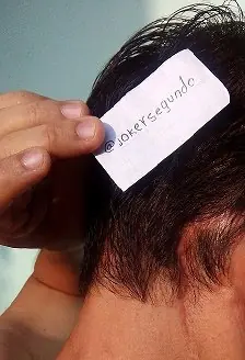 neurinoma del acustico