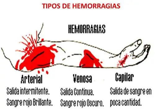 dolor