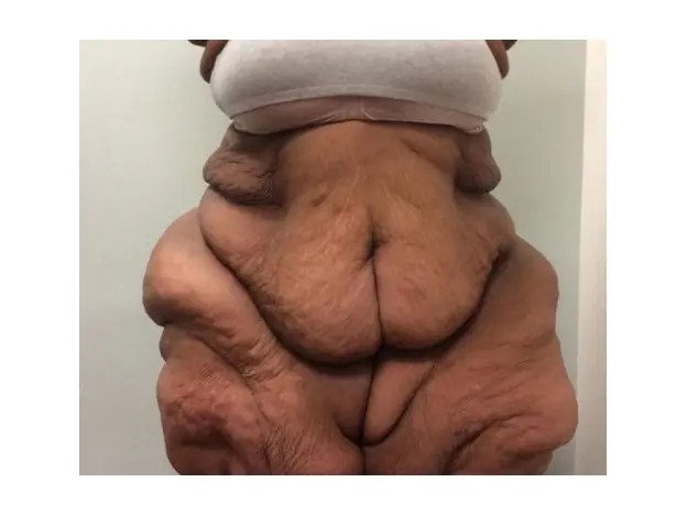 gorda gorda