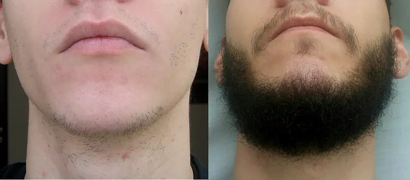 barba barba