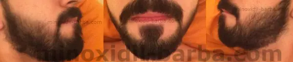 barba barba
