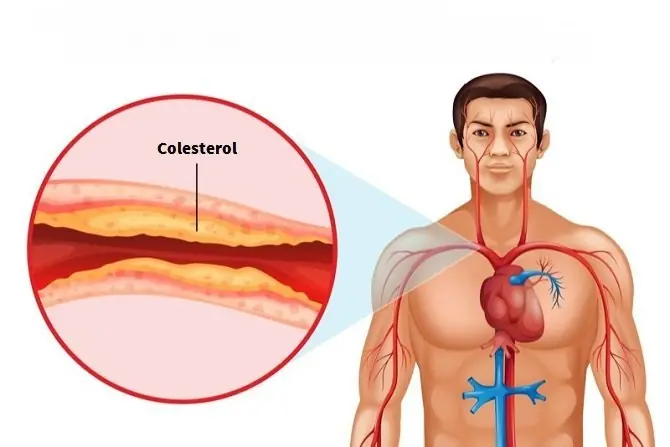 presion arterial