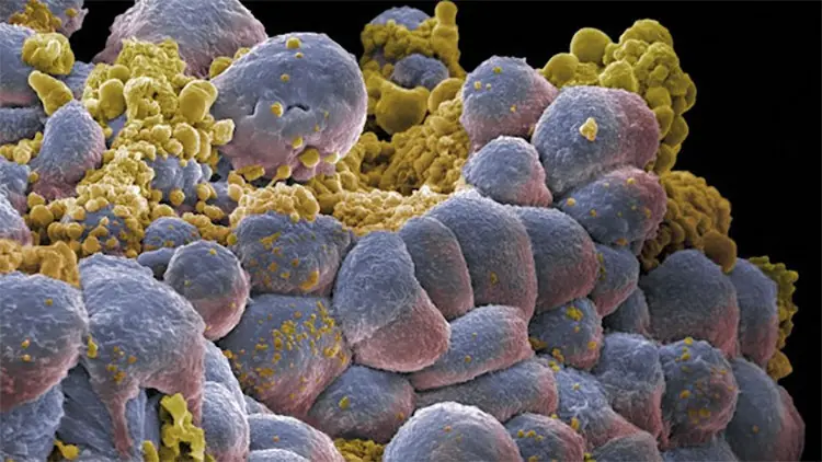 Científicos revelan causas del 90% de casos de cáncer