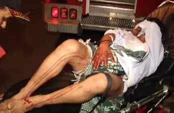 Le cortan el pene y le sacan dientes a otro por casarse...