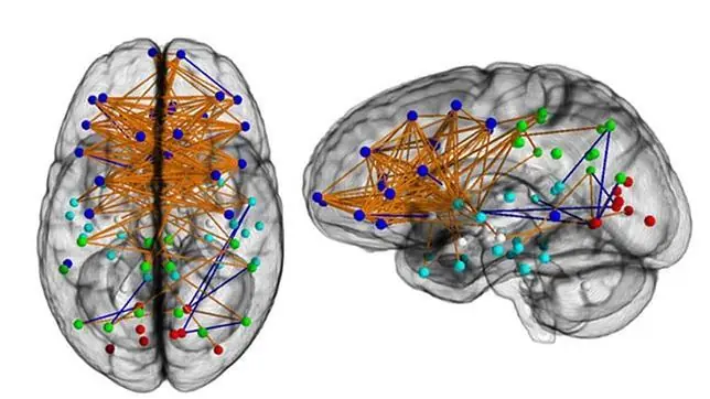 La verdad: Diferencia entre cerebros de hombre y mujer