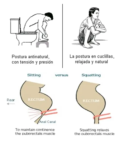 caca