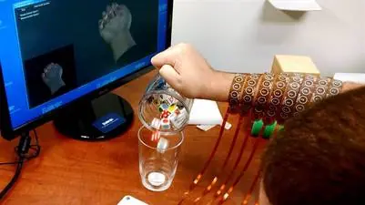 Un microchip ayuda a tetraplejico a usar la mano. guiñoguiño