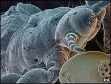 Descifran el genoma del piojo del cuerpo humano