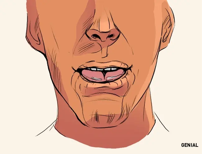este