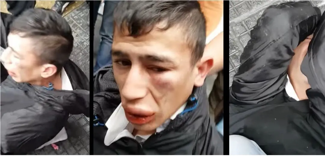 Vecinos desfiguraron Delincuente