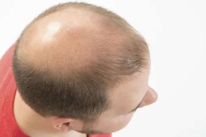 pelos